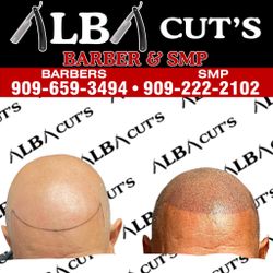 Are You Suffering From Hairloss? Do You Wish You Had A Hairline?? Then Scalp Micro Pigmentation Is Perfect For You! 