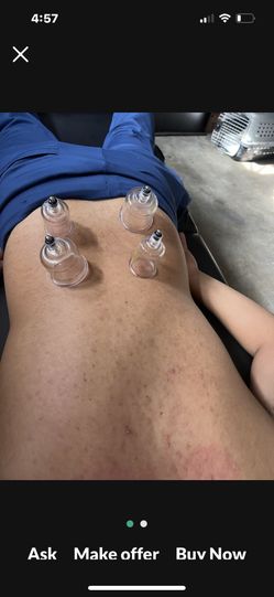 Ventosas Sobada Y Más 