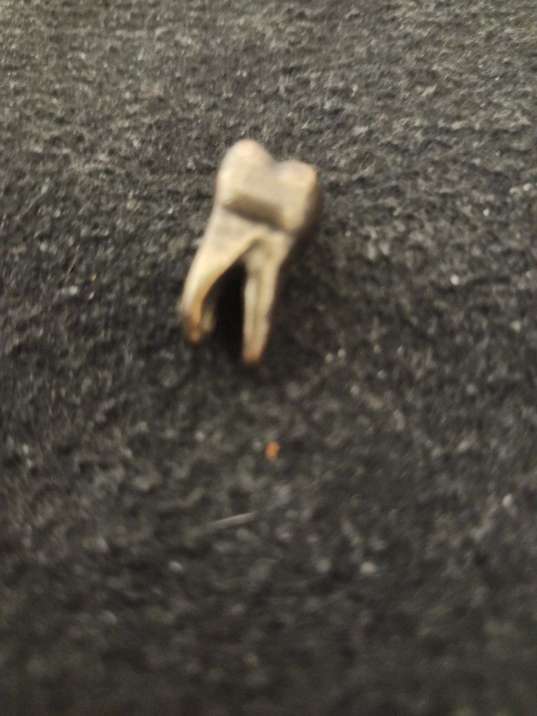 Tooth