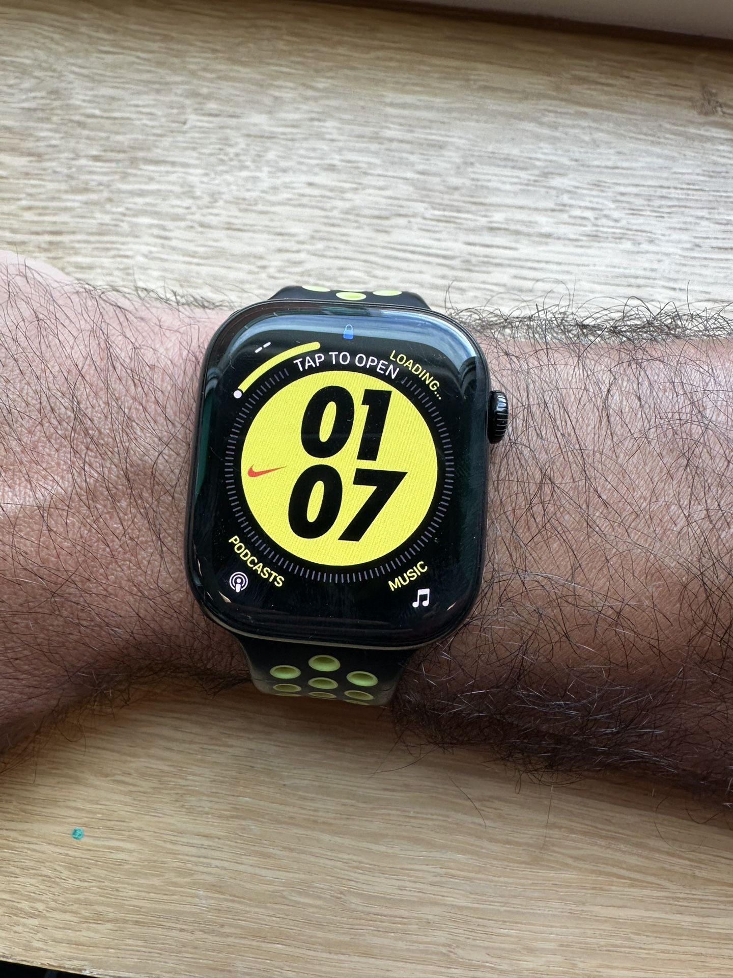 Apple Watch Series 10 (GPS, 46mm) – Jet Black Aluminum