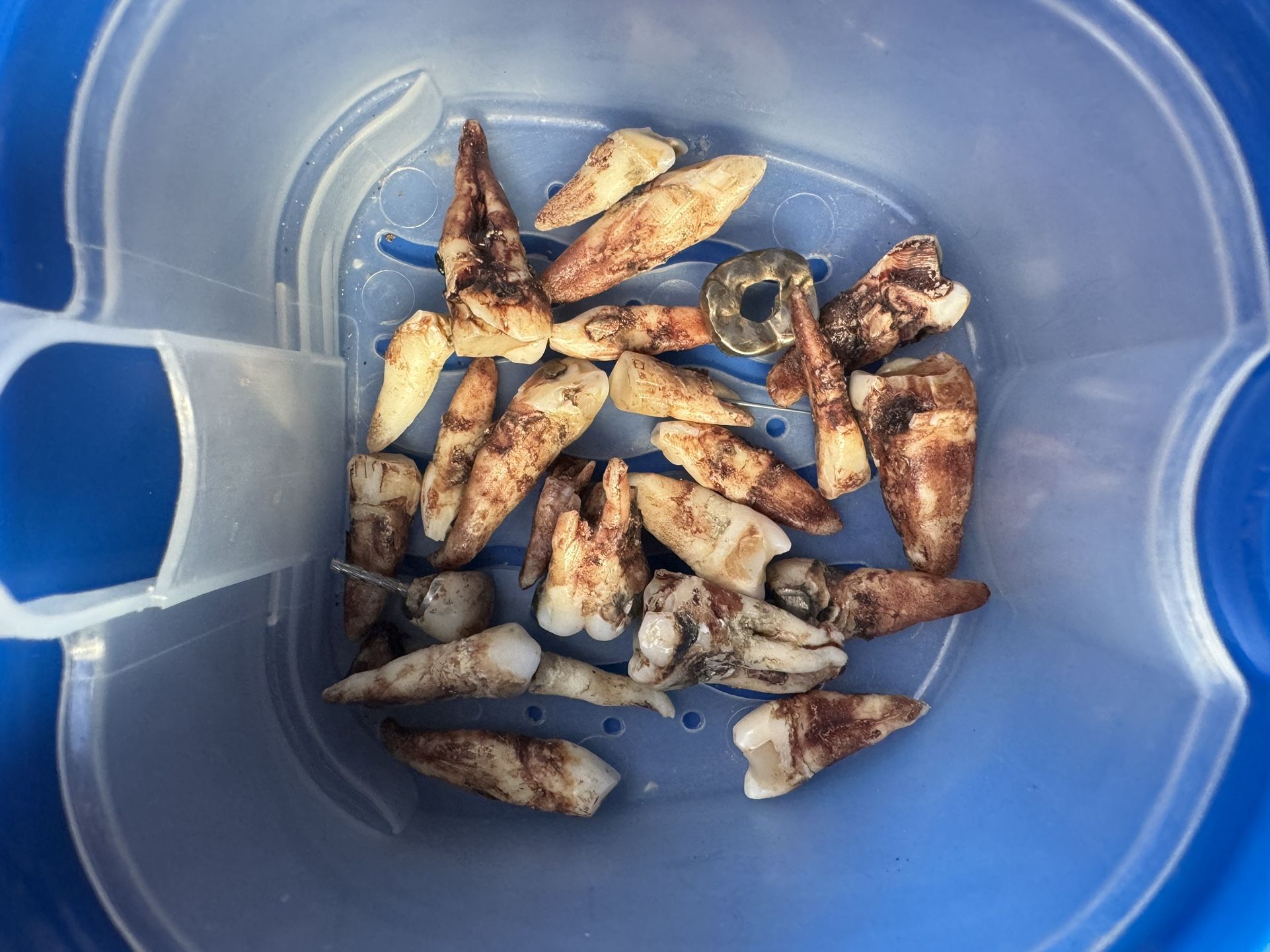 Human Teeth
