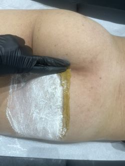 Sugaring Hair Removal