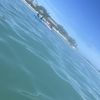 ERI