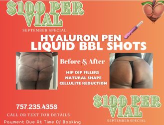 Free Consultation Body Sculpturing