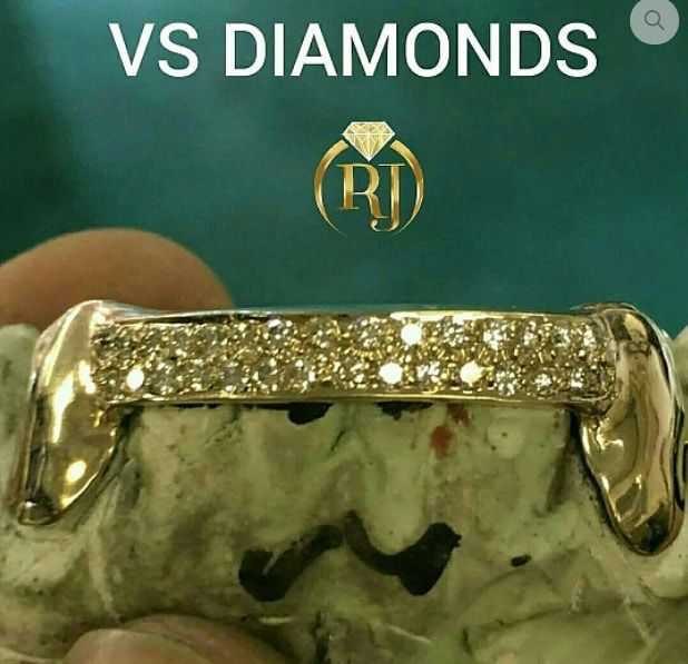 New Gold Smile ๐ 10K - 24K Gold Grillz