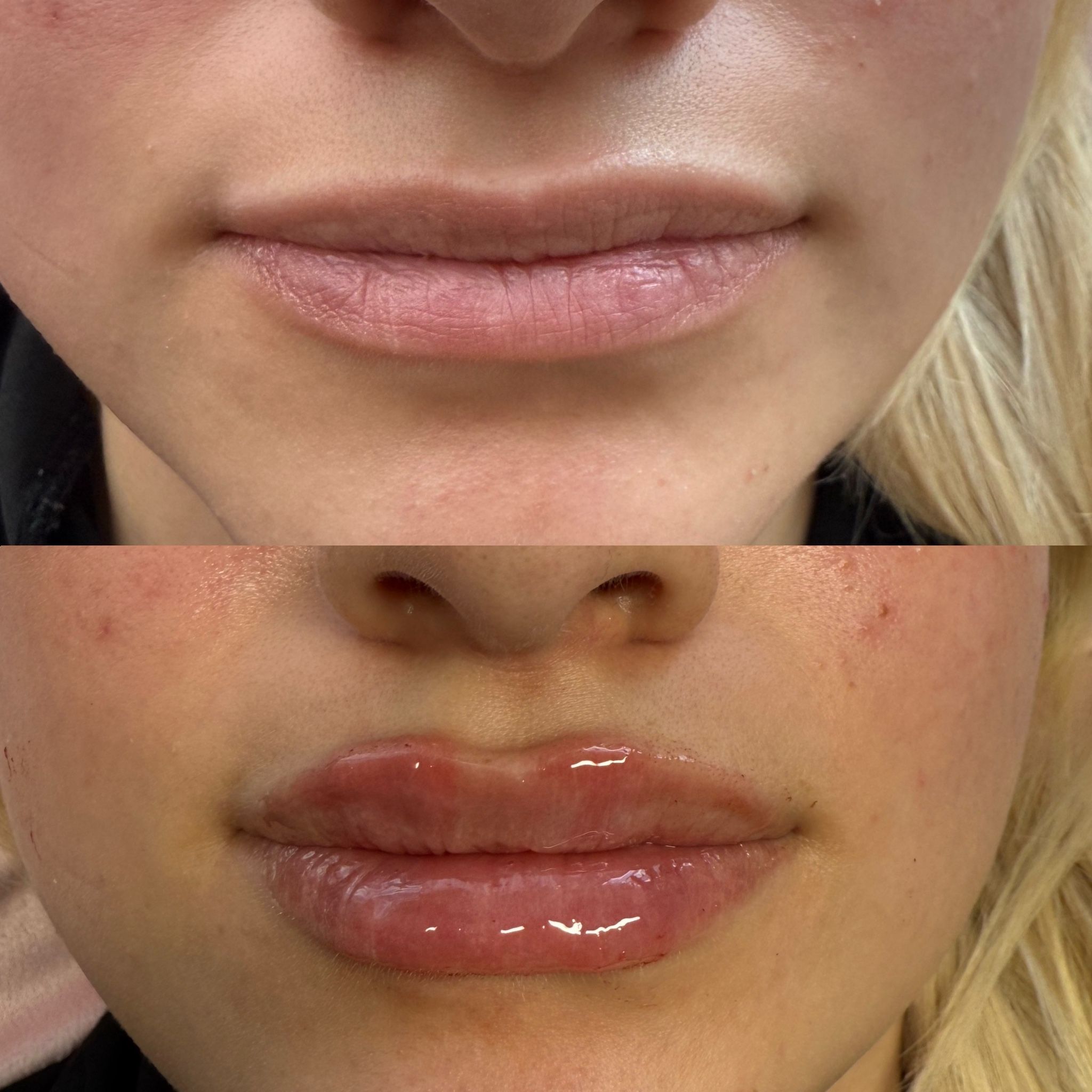 Lips