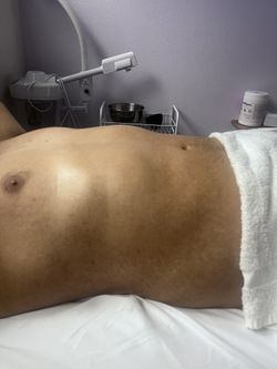 Massage Lymphatico