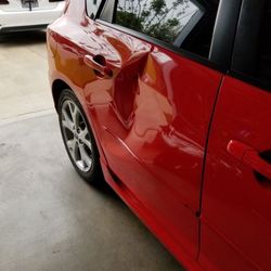 DENT PDR