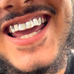 Silver Pull Out Grillz 