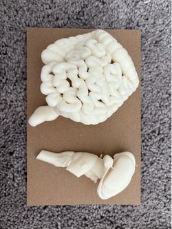 3D Printed Anatomical Models