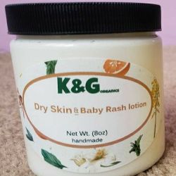 Dry Skin And Baby Rash Lotion