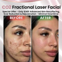 Skincare - Cuidado de la Piel