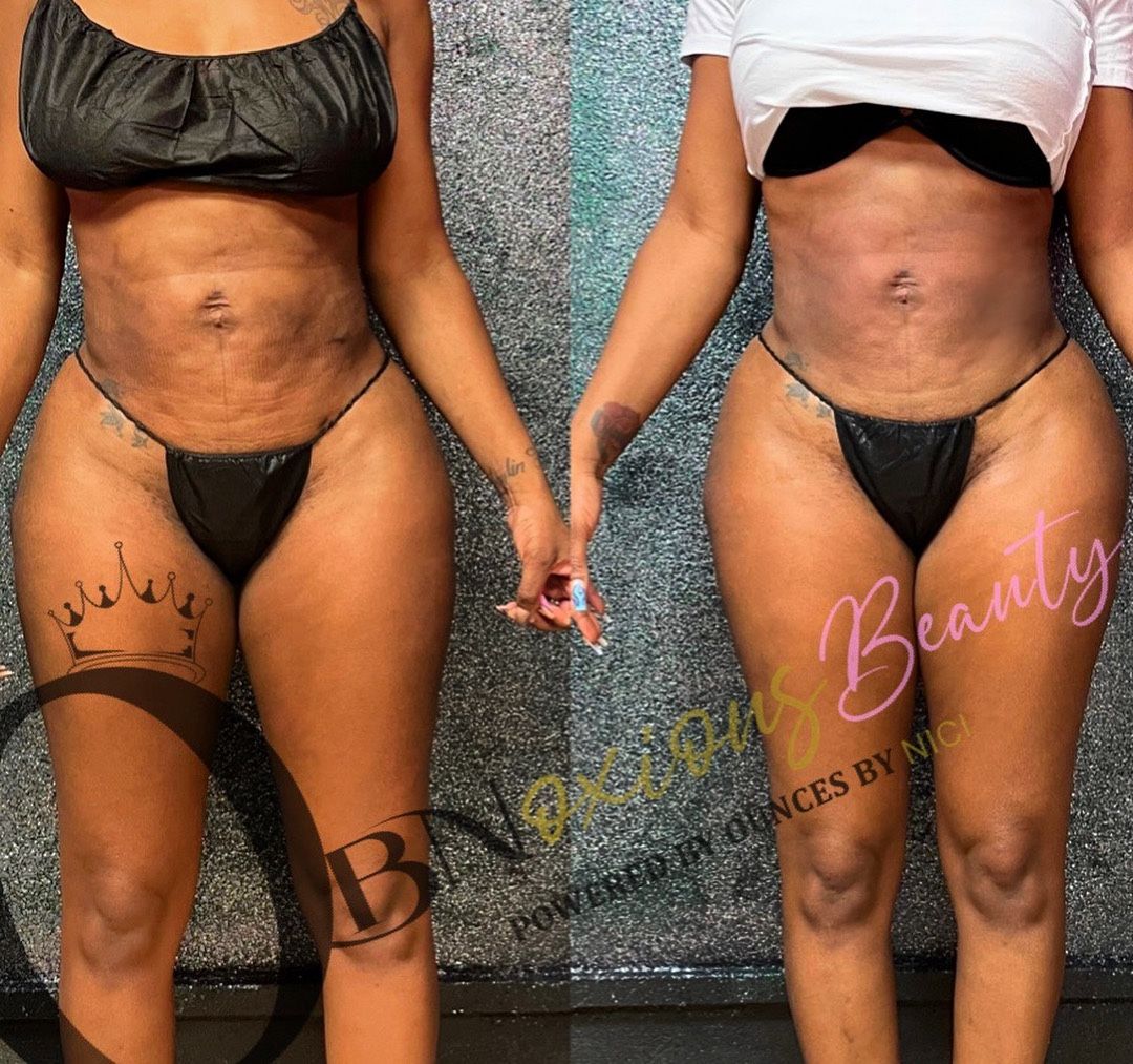 OBNoxious Beauty Buckhead BODY SCULPTING AND SKIN REJUVENATION