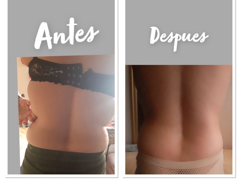 Maderoterapia corporal