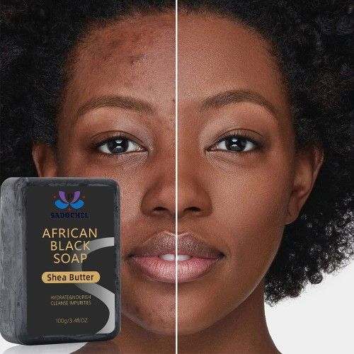 Organic African Black Soap With Shea Butter