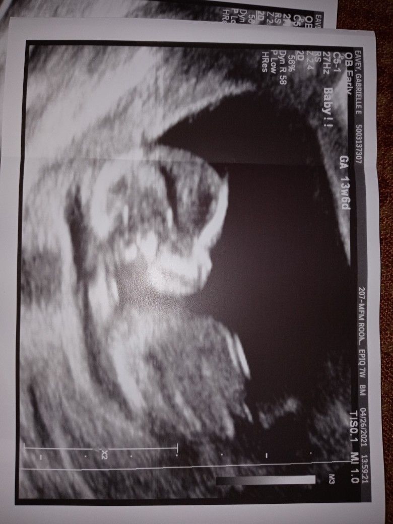 In Need Of New Born Boy Items.