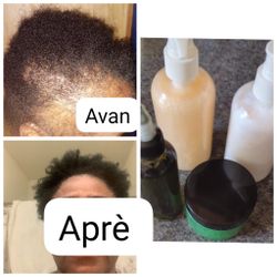Hair Growth Oil ( Luil Mirak La )