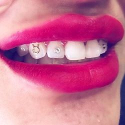 Tooth Gem