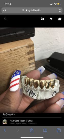 Gold grillz