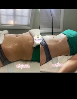 Body Sculpting Cavitation Wood Therapy And More