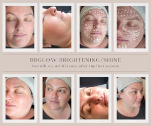 BBGLOW BRIGHTENER