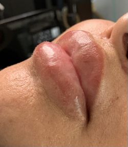 Lips 👄