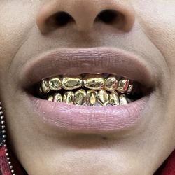 Gold Grills! Real 10k, 14k, 18k Gold Teeth