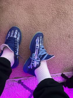 Kobe 5 xray with box