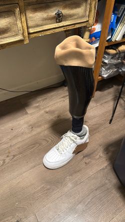 Above -Knee Prosthetic Leg with Foot