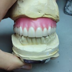 Removables Dentures , Dentaduras Removibles