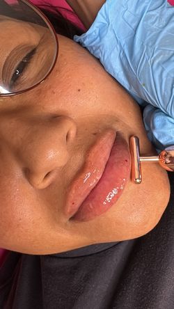 Lips