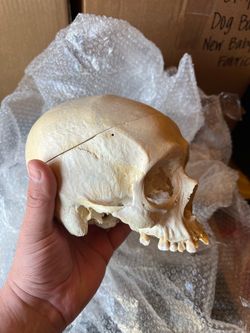 Medical Display Skull