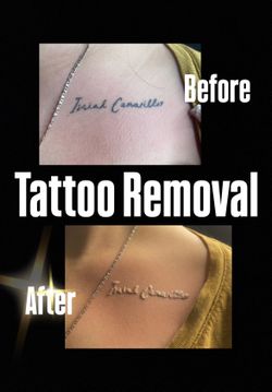 Removal