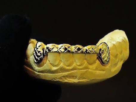 10kt 6pcs Grillz Yellow Gold White Gold Rose Gold Any Design For $325