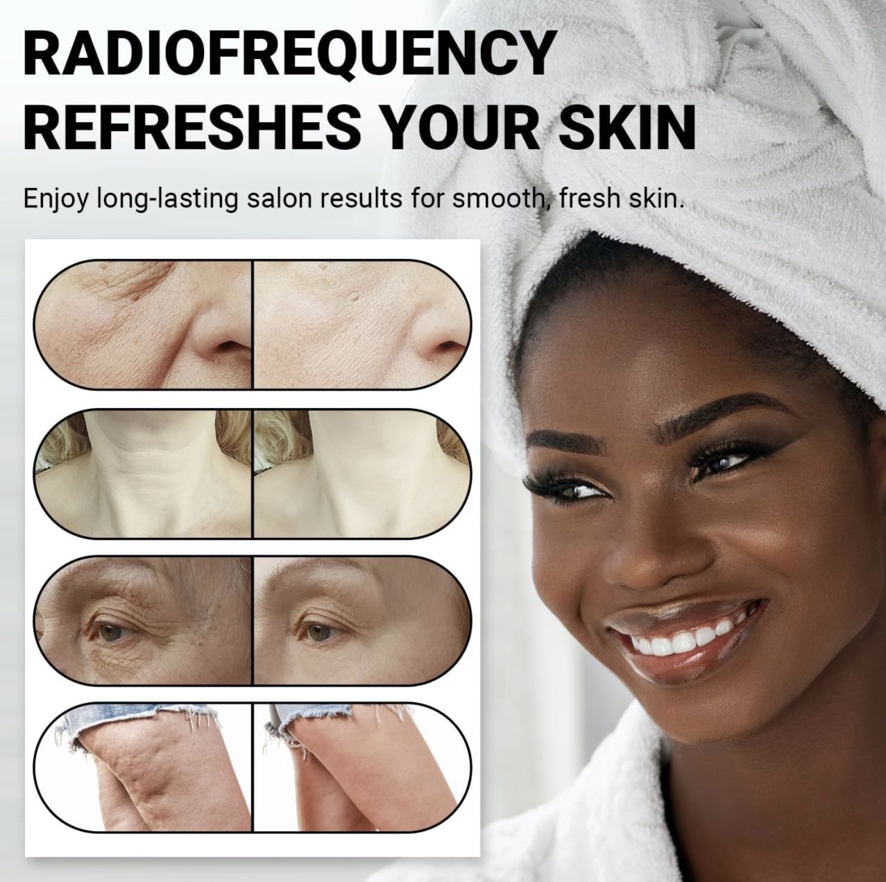 Radio Frequency orders Skin Tightening Machine