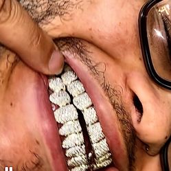 Flawless Grillz 💎Same day available❗️