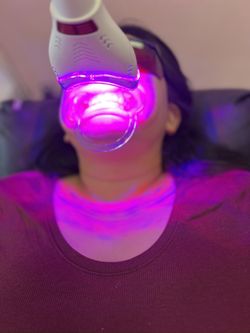 Whitening