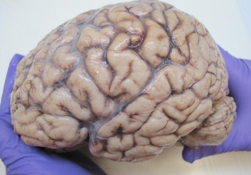 brain