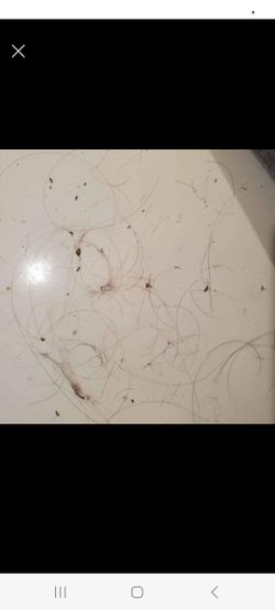 Elimina Las Liendres Y Piojos EN TAN SOLO UNA APLICACIÓN MIRA LOS RESULTADOS 1 PEINE 1KERATINA