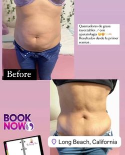 Pierde Peso Y Luce Un Cuerpo Esbelto Con Nuestro Tratamiento