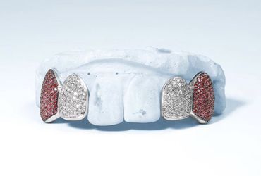 Diamond teeth!!! KDs Custom Jewelry