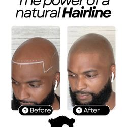 Scalp Micropigmentation For Men And Women $100 OFF First Clients 