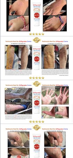 Crema Para La Resequedad/ Infección De La Piel