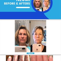 A NewYOU!!! Begins With Neumi!!!