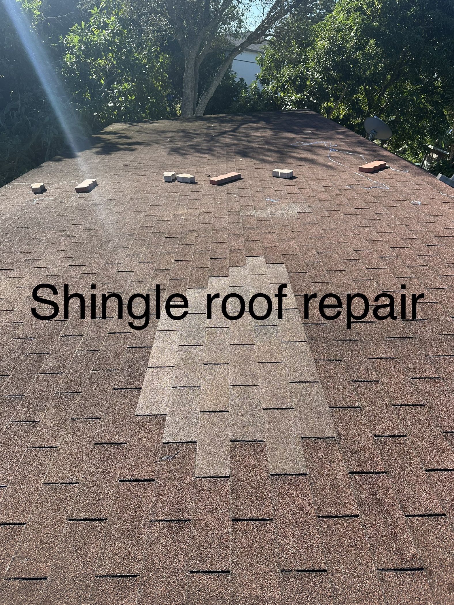Shingles