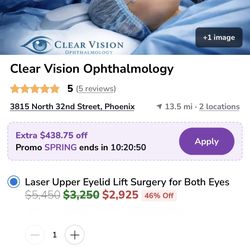 Laser Upper Eyelid Lift Surgery for Both Eyes