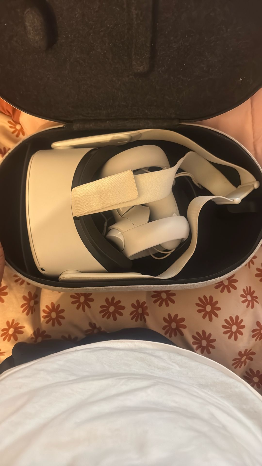 oculus