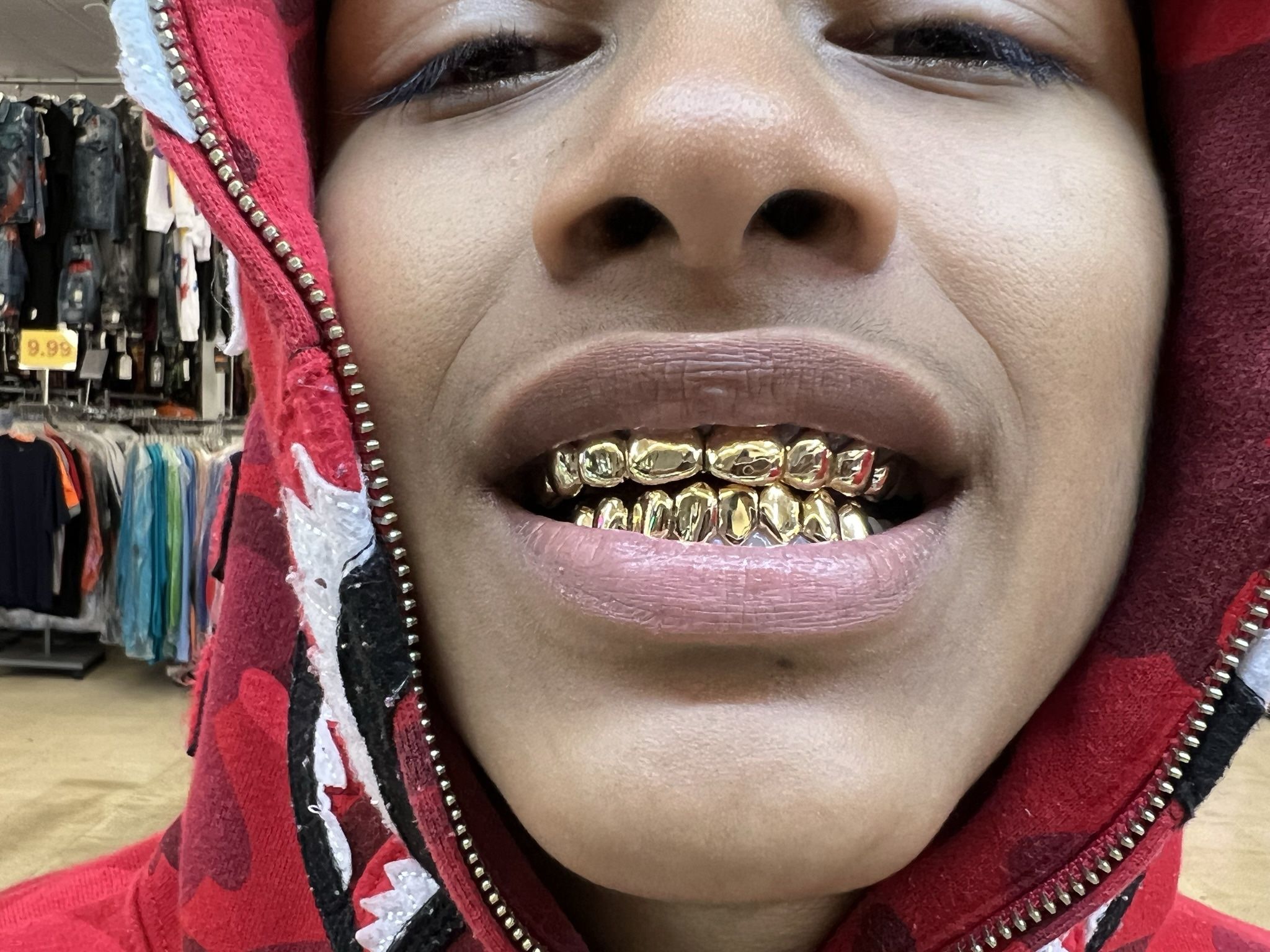 Gold Grills! Real 10k, 14k, 18k Gold Teeth