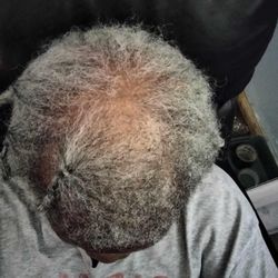 Miracle Hair Growth oil