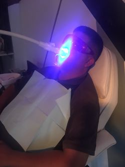Teeth Whitening Sale